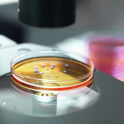 Petrischale mit Keimen unter Mikroskop