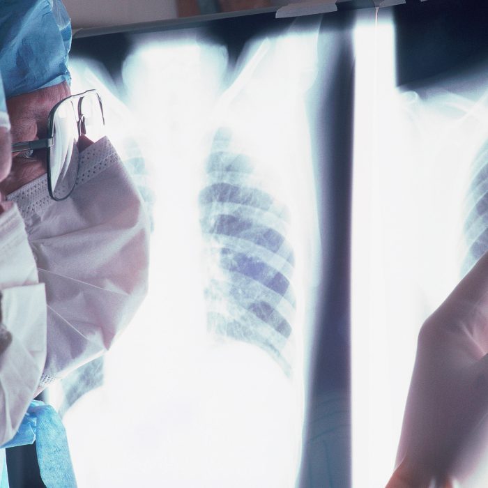 Zwei Mediziner schauen auf Röntgenbilder